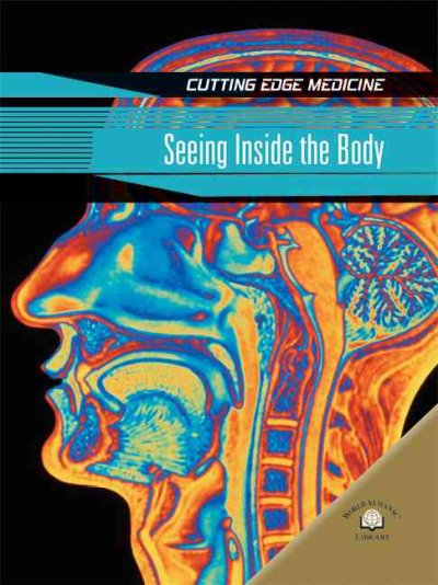 Seeing inside the body / Andrew Solway.