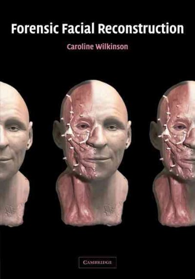 Forensic Facial Reconstruction.
